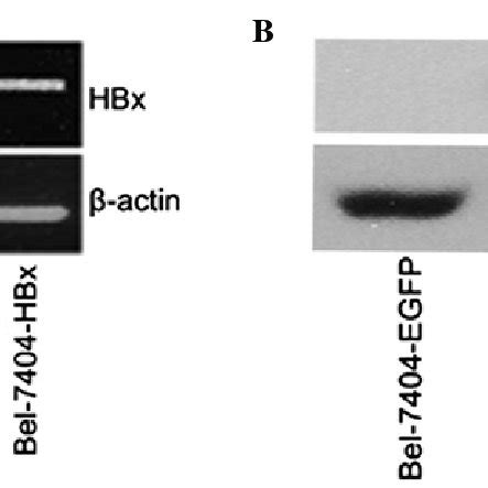 Identification Of Stable Hbx Transfection In Bel Cells A