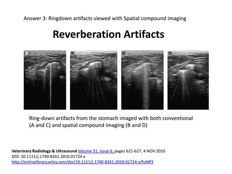 Reverberation Artifacts In Ultrasound Imaging Ppt