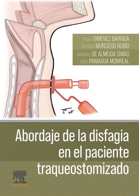 Abordaje De La Disfagia En El Paciente Traqueostomizado En LALEO