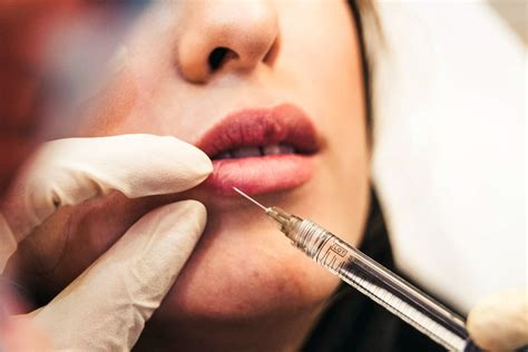 The Complete Guide To Dermal Injectable Fillers Cosmed Laser Center