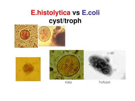 Ppt Amoeba Kelas Rhizopoda Protozoa Bergerak Dg Pseudopod I Kaki Semu Powerpoint