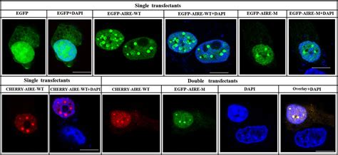 Frontiers A Novel AIRE Mutation Leads To Autoimmune Polyendocrine