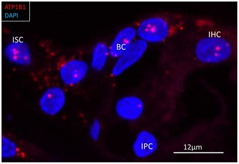 Frontiers Na K Atpase Gene Expression In The Human Cochlea A Study