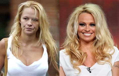 15 Famous Drug Addicts Before And After Pictures New Health Advisor