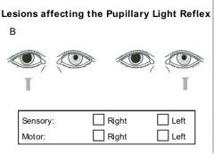 Neuroanatomy Lecture 31 Ocular Reflexes Flashcards Cram