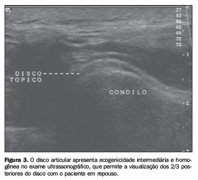 Scielo Brasil Avalia O Ultrassonogr Fica Dos Dist Rbios