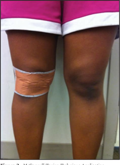 A Comparison Of Two Taping Techniques Kinesio And Mcconnell And Their