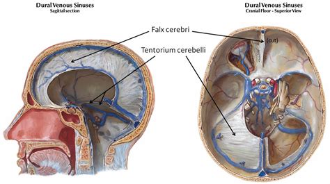 Brain herniation causes, types, signs, symptoms, prognosis and treatment