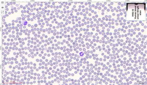 On A Blood Smear Slide Prepared Using Wright S Stain