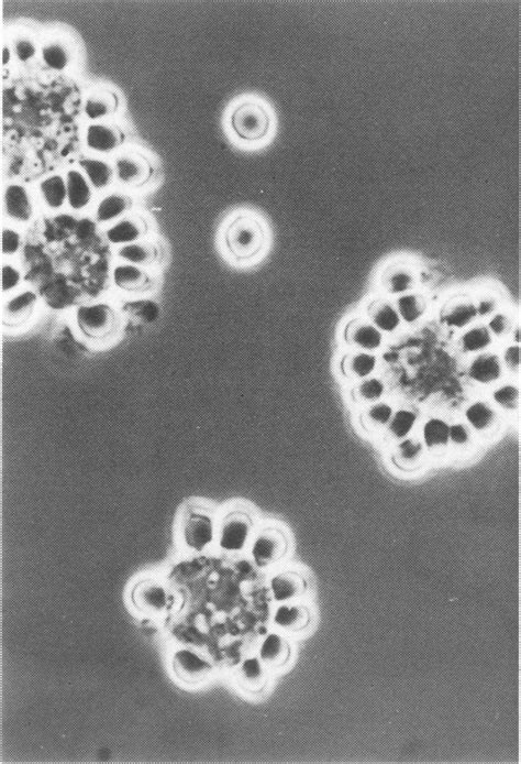 B Ten Day Old Macrophages With Attached Antibody Coated Sheep Red