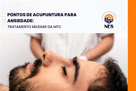 Pontos De Acupuntura Para Ansiedade Tratamento Milenar MTC