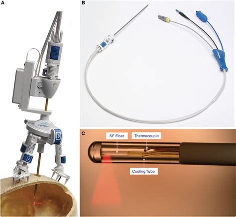 Frontiers Stereotactic Laser Ablation For Medically Intractable