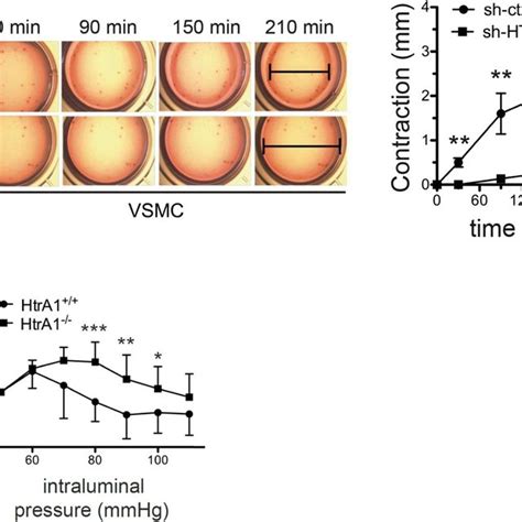 Loss Of HTRA1 In VSMC Impairs Contractility A Cell Contraction Of