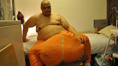 ‘the Man With The 132 Pound Scrotum Unraveling The Medical Mystery Cnn