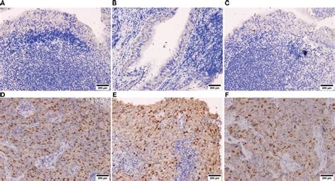 GSEA Analysis Of Differentially Expressed Genes DEGs A GSEA