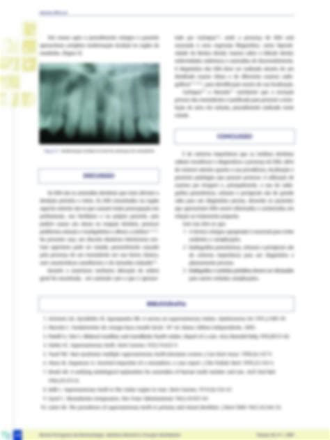 SOLUTION Abordagem Cir Rgica De Dente Supranumer Rio Mesiodens Na Regi