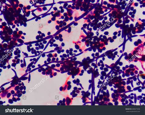 Budding Yeast Cell Structure Fine Microscope Stock Photo