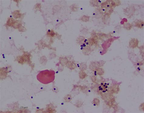 Acinetobacter Gram Stain