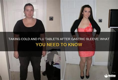 Taking Cold And Flu Tablets After Gastric Sleeve What You Need To Know