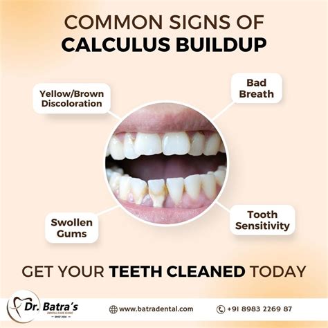 common signs  symptoms  gum disease