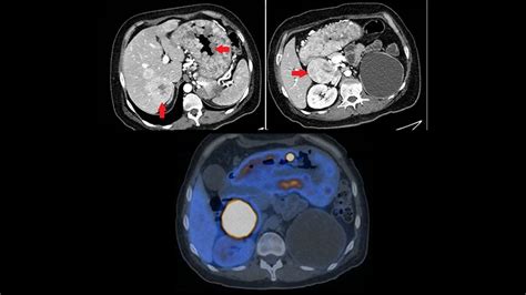 Minutos De Endocrinolog A Paciente Masculino Con Dolor Abdominal Y