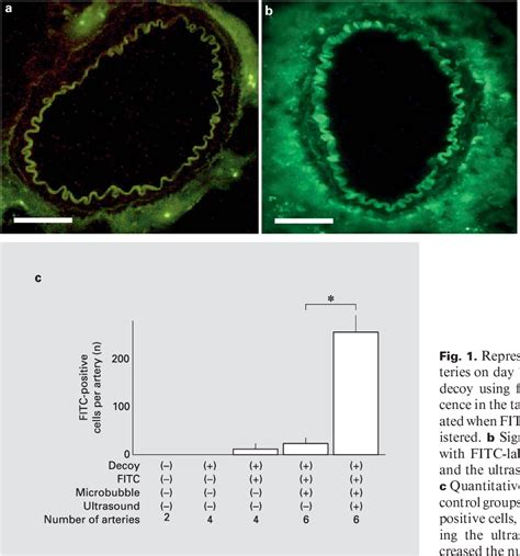 Figure 1 from Ultrasound Microbubble Mediated NF κB Decoy Transfection