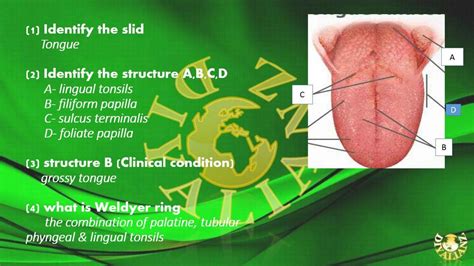 Solution Oral Pic Ospe Studypool