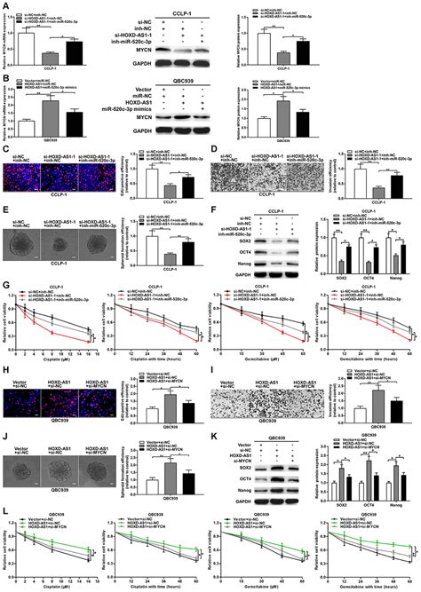 Sp1 Induced Hoxd As1 Promotes Malignant Progression Of