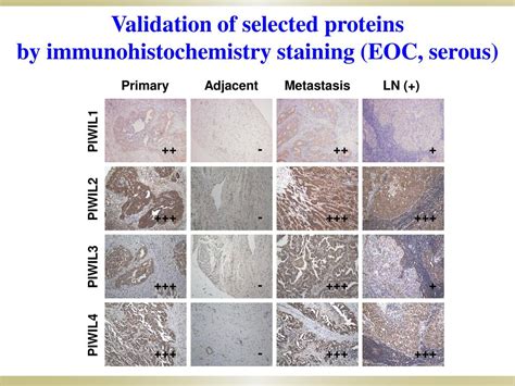 Progression Markers Of Human Epithelial Type Ovarian Tumors Ppt Download