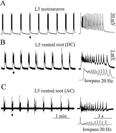 Comparison Of Intracellular And Extracellular Recordings Of Bursting