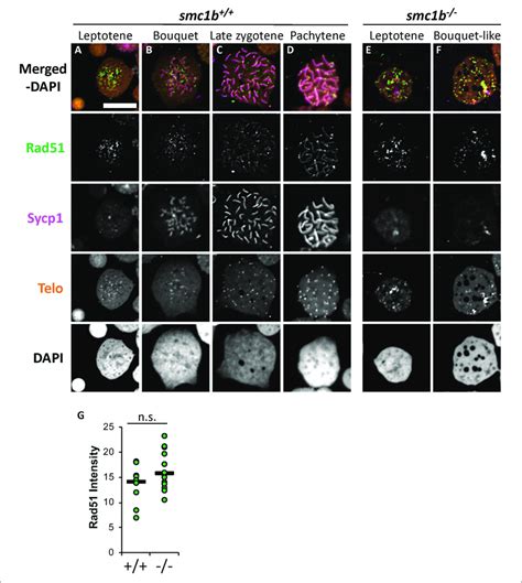 DNA Double Strand Break And Recombination Marker Rad51 Was Expressed