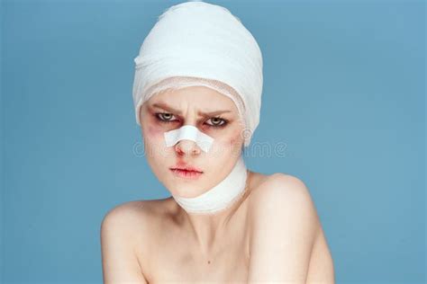 Girl Bruised Eye Stock Photos - Free & Royalty-Free Stock Photos from Dreamstime