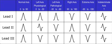 Bifascicular Blocks - What You Need To Know - ECG Medical Training ...