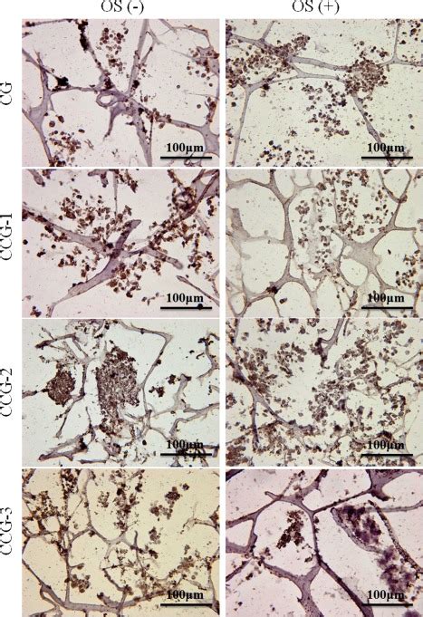 Factor Viii Immunohistochemical Staining Of Admscsscaffold Constructs Download Scientific