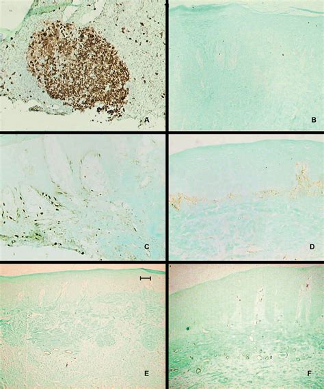 Ki And Sma Immunostaining A Ki Immunostaining In Positive