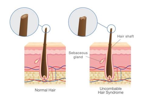 60+ Hair Shaft Diagram Stock Illustrations, Royalty-Free Vector ...