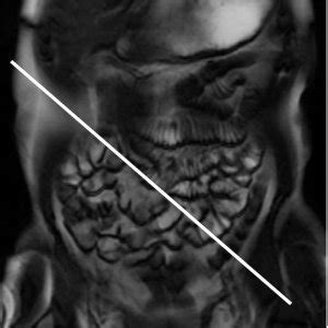 Acceleration Of Small Bowel Motility After Oral Administration Of Dai