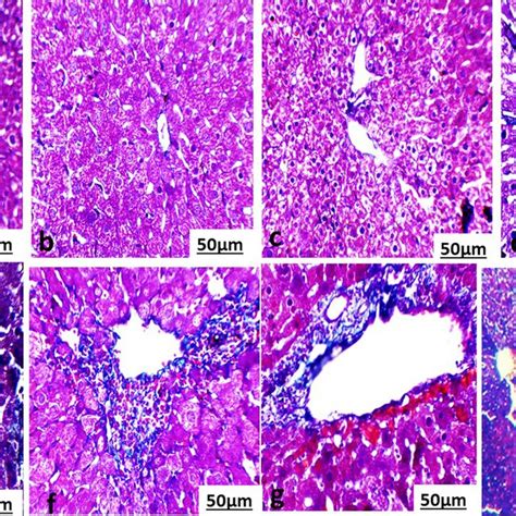 Photomicrograph Of A Liver Section Of A Normal Mouse And B Liver