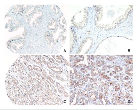 Asap Protein Expression Shown By Immunohistochemistry In Sections Of