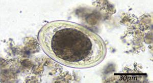 Ascaris Lumbricoides Decorticated Egg