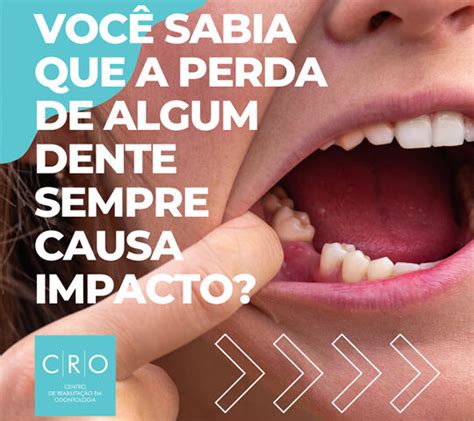 Perda De Dente E Impactos Cro Odontologia