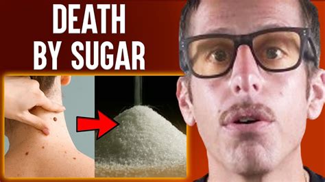 7 Warning Signs You Re Eating Too Much Sugar Ben Azadi Youtube