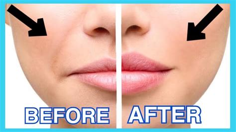 Smile Lines Facial Exercises And Massage Nasolabial Folds Laugh Lines