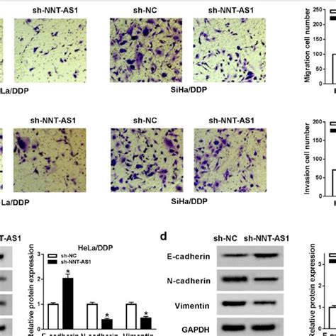 Knockdown Of Nnt As1 Inhibits Migration Invasion And Emt Of Download Scientific Diagram