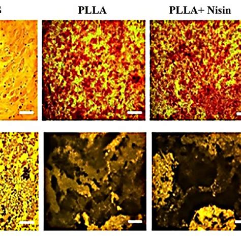 Alizarin Red And Von Kossa Staining To Confirm The Osteogenic Download Scientific Diagram