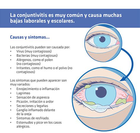 【como Se Contagia La Conjuntivitis】 ️