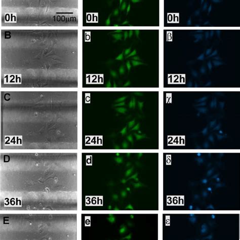 Representative Phase Contrast And Fluorescent Images Of Hela C Cells