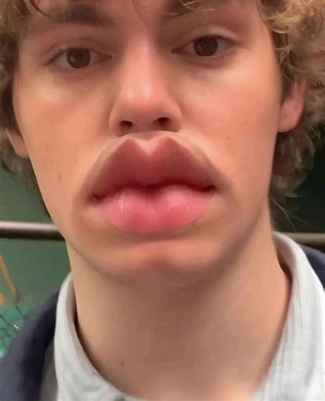 Jack Champion Whit Duck Lip🦆🦆🦆🦆 Champion Jack Singer