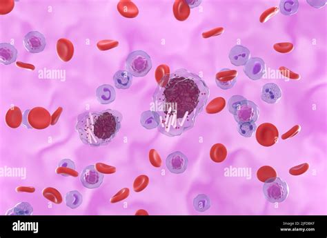 C Lulas De Leucemia Linfoc Tica Cr Nica Llc En El Flujo Sangu Neo