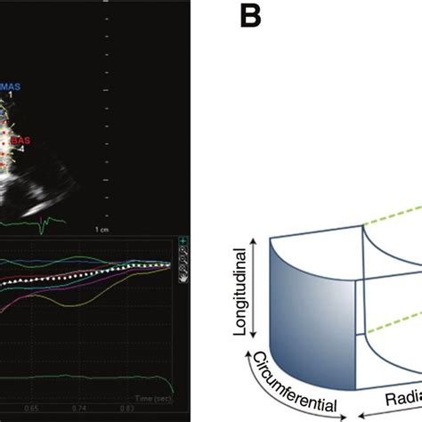 Speckle Tracking Echocardiography Ste And The Three Orthogonal Axes